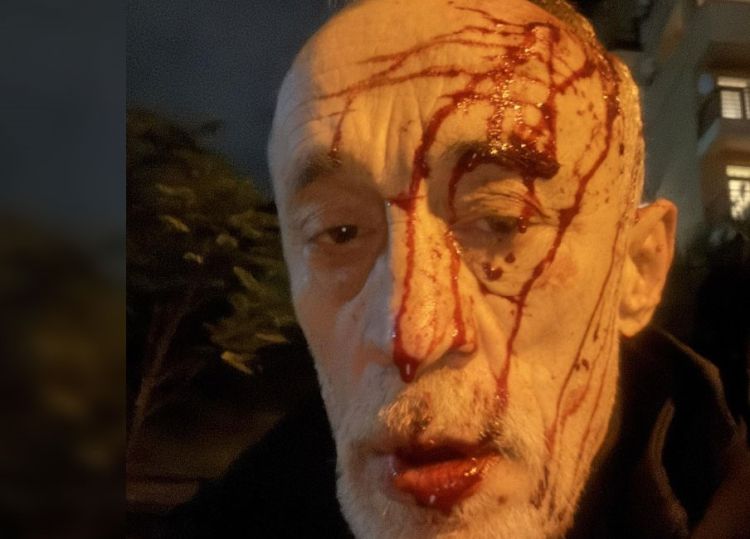 ნადიმ ხმალაძეს ჩაუსაფრდნენ და თავს დაესხნენ